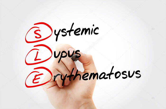Ways to Live better with SLE LUPUS
